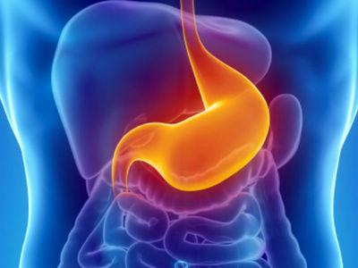 胃食管反流检测