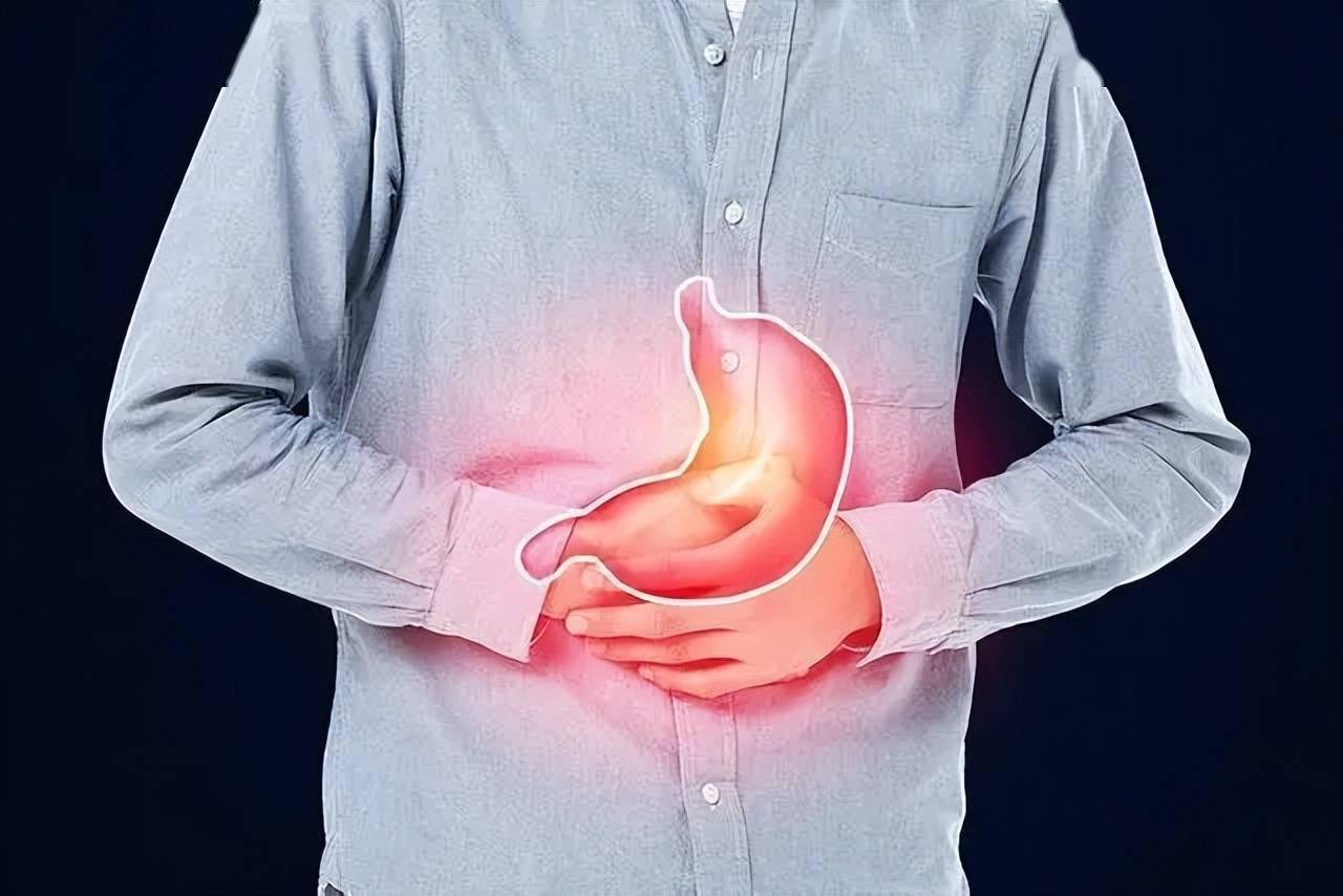 胃食管反流病检测